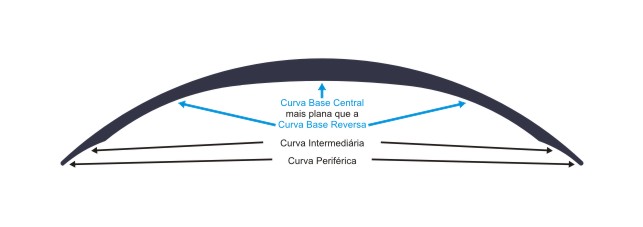 Imagem que ilustra superfície interna composta por curvas base, reversa e periférica da lente Planex